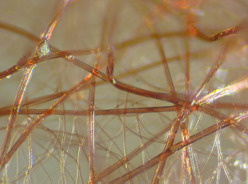 Ovatura di Ero sp. (Mimetidae)